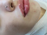 &