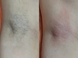 &