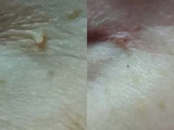 &