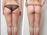 &