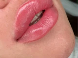 &
