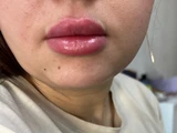 &