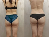 &