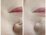 &