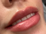 &