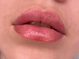 &