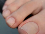 &