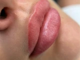&