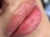 &