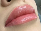 &