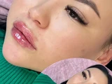 &