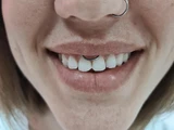 &