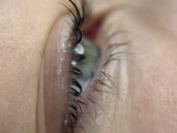 &
