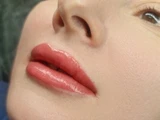 &