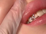 &