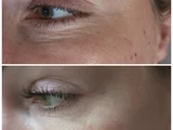 &