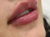 &