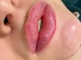 &