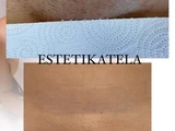 &
