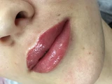 &