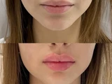 &