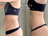 &