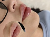 &