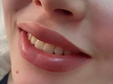 &
