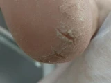 &