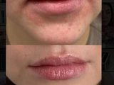 &