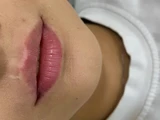 &