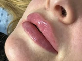 &