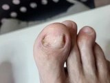 &