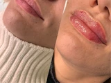 &