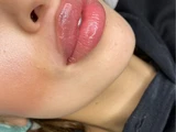 &