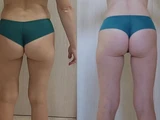 &