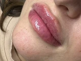 &