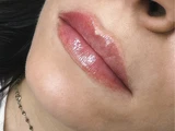 &