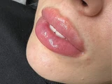 &