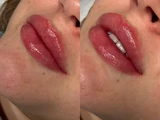 &