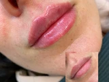 &