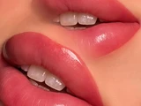 &