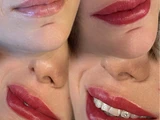 &