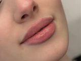 &