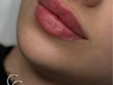 &