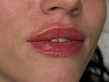&