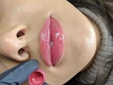 &