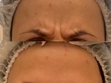 &
