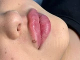 &