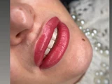 &